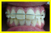 ortodoncia<pre></pre>